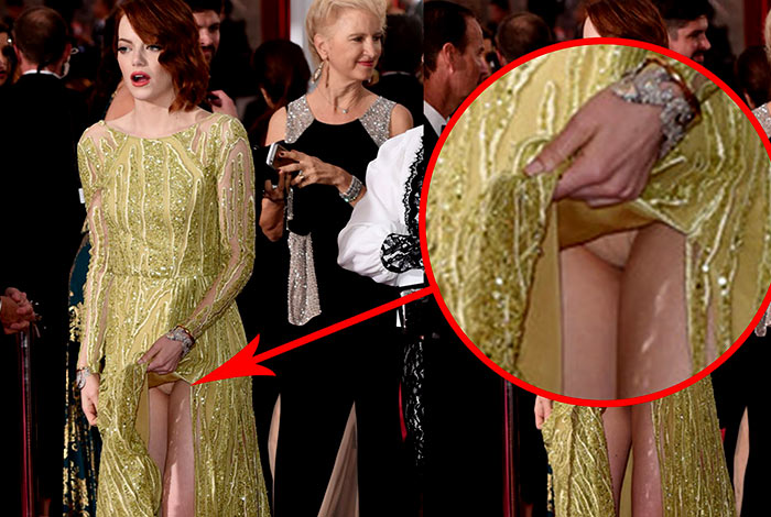 Emma Stone